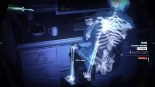 Batman&trade;: Arkham Knight The killing Joke Easter Egg Oracle's broken spine