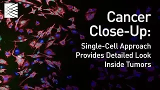 Cancer Close-Up: Single-Cell Approach Provides Detailed Look Inside Tumors (2016)