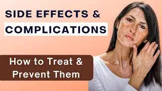 Long Term Delayed Side Effects of a Chemical Peel