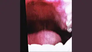 baroque
