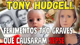 O drama de Tony Hudgell: incha&ccedil;o e dor nas pernas desde pequeno