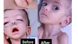 Week-Old Neonatal Baby in NICU | Gasping and Critical.@☆Payer's 🤲😭●!!