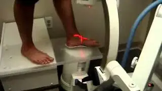 Recurrent Talotarsal Dislocation: Evaluation of Custom Foot Orthosis