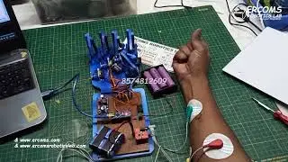 ERRB047 ||  Prosthetic Hand sing EMG Sensor
