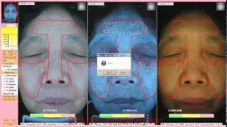 BS 3200 facial skin analyzer machine