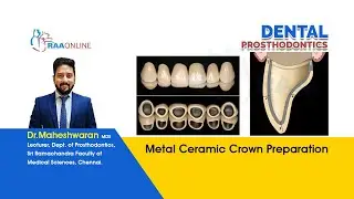 Metal Ceramic Crown Preparation