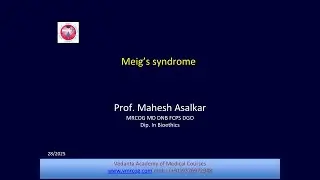 Meigs Syndrome