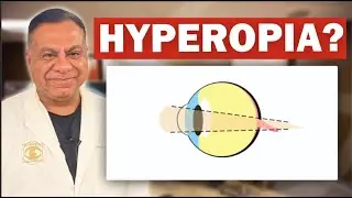 What is Hyperopia or Farsightedness? - Dr Motwani Explains