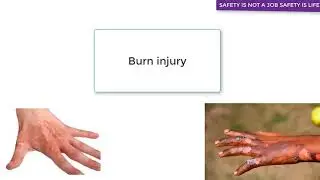 Construction hazards and its safety