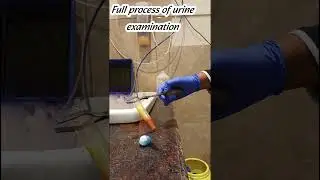 Full Process of Urine Routine 🔬 Examination /Urine Test /Urine Routine #lab #urine_infection #dr