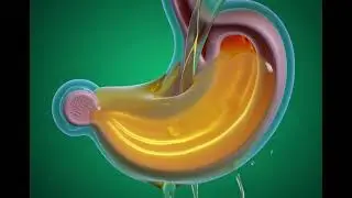3D Cutaway What Happens When Lemon Hits Your Stomach
