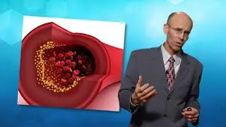 LifeStart 03 - Reverse Heart Disease Naturally