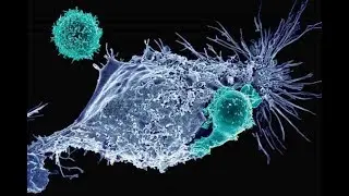 Car T, la nuova terapia contro i tumori