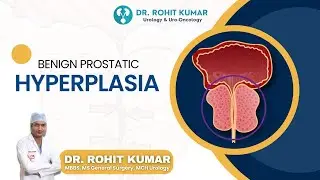 Understanding BPH: A Common Urinary Problem in Aging Men | Dr. Rohit Kumar, Urologist