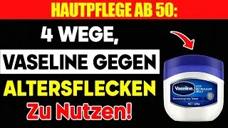 Altersflecken entfernen: Der Vaseline-Trick vom Hautarzt (Billig & Effektiv)