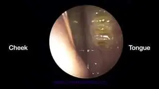 Rabbit Dentistry Ep. 1
