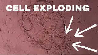 When Reproduction Goes Wrong - Ciliate Starts Leaking