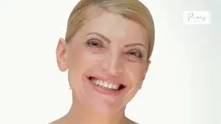 SkinPen Microneedling in Prosper, TX | Reduce Scars & Fine Lines