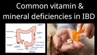 Common vitamin & mineral deficiencies in IBD 