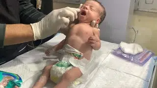 Cute Neonatal Baby with Bronchiolitis 👶💨Feeding, Nebulization & Nurse Care #nicubaby #Bronchiolitis