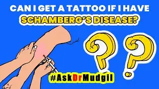 CAN I GET A TATTOO IF I HAVE SCHAMBERG&rsquo;S DISEASE?