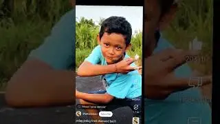 tangannya nggak infus sehat-sehat aja tiba-tiba diinfus gajah sehat Sultan apa batu bata batu bata