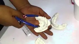 Analisis de Korkhaus