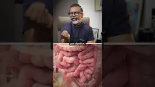 Помогает ли яблочный уксус похудеть?