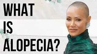 Hair Loss: The Different Underlying Causes Of Alopecia | The Art of Being Well | Dr. Will Cole