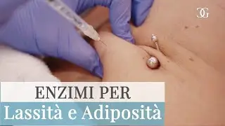 Trattamento con ENZIMI per Adiposit&agrave;, Cellulite e Lassit&agrave; cutanea - Dr.ssa Beatrice GIORGINI