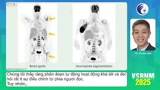 1. AI trong Y học hạt nh&acirc;n (TS.BS. Charles Goh)