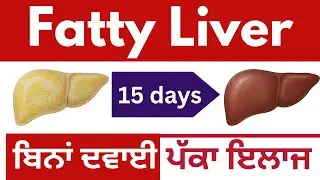Fatty liver causes,precautions, treatment and home remedies #liverhealth #fattyliver