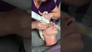 Crystal Clear Microdermabrasion