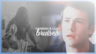 Hannah & Clay | Bruises