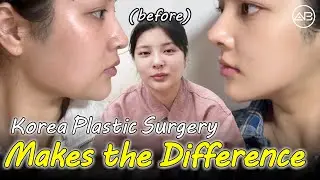 My Double Chin & Nose Surgery Experience in Korea | AB Plastic Surgery