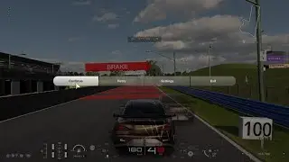 Sim Racing as an amputee