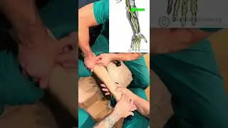 Elbow Pain? It Might Be Your Median Nerve