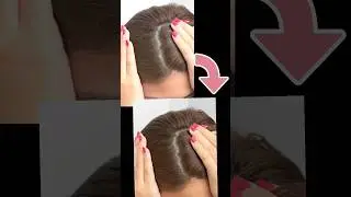 Remove Dandruff in Photoshop! Quick & Easy Tutorial