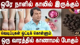 இதைப் போட்டு தூங்குங்கள் | Cracked Feet: Causes & Home Remedies | Patha vedippu | Dr.Anbuganapathi