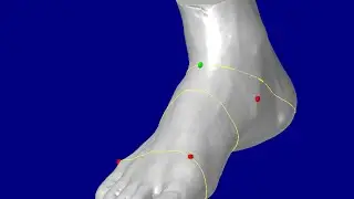 Scanned 3D shape by foot scanner 'INFOOT'