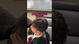 ZSA for Autism Treatment