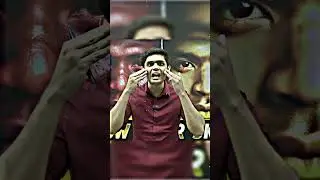 Reasons for pimples 😱💯 #prashantsir #pimple
