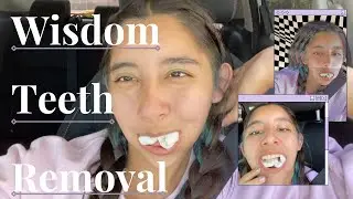 Wisdom Teeth Removal