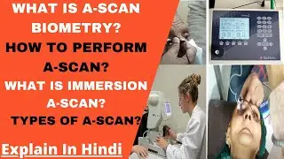 What is A scan Biometry?How to Perform A scan? How to Calculate IOL?A Scan Biometry Explain in Hindi