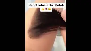 Undetectable Hair Patch😍😍😍 Get Now