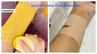 Fair Hand Tips | Clean Hand Dirt & Tanning | Skin Brightening Tips & Trick 