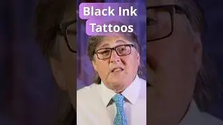 Black Ink tattoo Removal Suprise