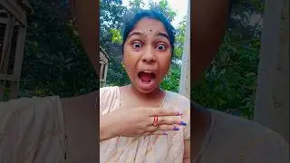 I Ate My FingerMagic Trick#funnyfunnyFunny Shortsl