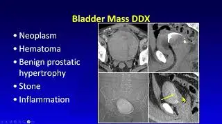 080 CT and MRI Imaging of the Bladder Freemedbooks.com