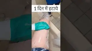 बिना Wax, 1 दिन में अनचाहे बाल हटाये| Hair Removal Easy at Home #facialhair #beauty #skincare